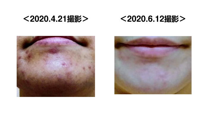 Before_after